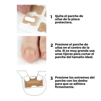 Pack de 50 Parches para Uñas Encarnadas + ENVÍO GRATIS